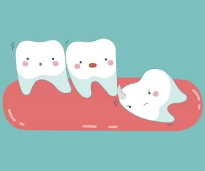 dentist-in-Armadale-wisdom-teeth-removal-800x579